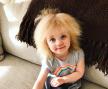kako danas izgleda beba s rijetkim sindromom kose?
