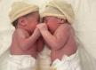 Blizanci rođeni porodom sirene oduševili liječnike