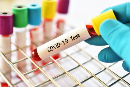 Covid-19 i testiranje na koronavirus