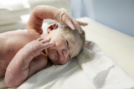 Beba s verniksom nakon rođenja