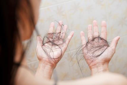 opadanje kose nakon poroda