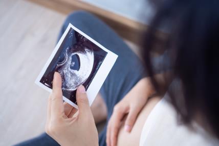trudnica gleda snimku ultrazvuka