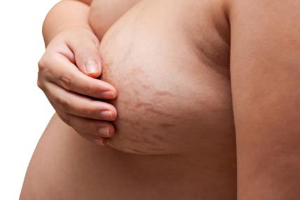 Kako se grudi mijenjaju u trudnoći