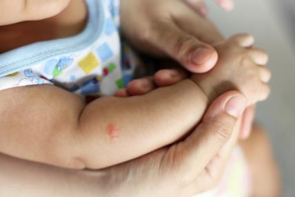 Je li ubod komarca opasan za bebu